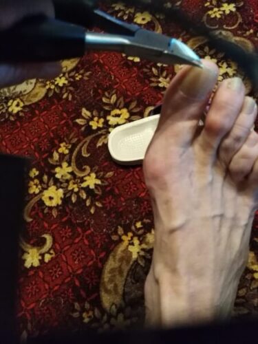 Professzionális körömcsipesz készlet vastag és benőtt körmökhöz (5 részes) | NAILPRO photo review